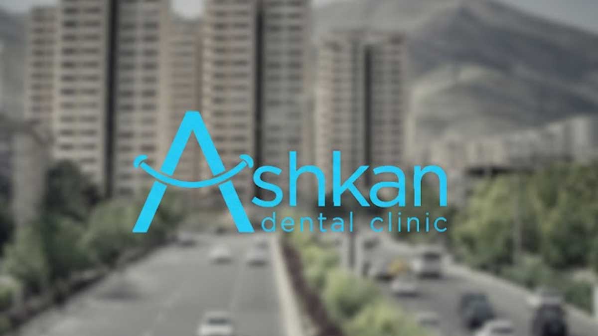 کلینیک دندانپزشکی در سعادت آباد ( کلینیک اشکان)