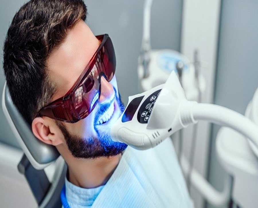 استفاده محصولات بدون نسخه برای سفید کردن دندان